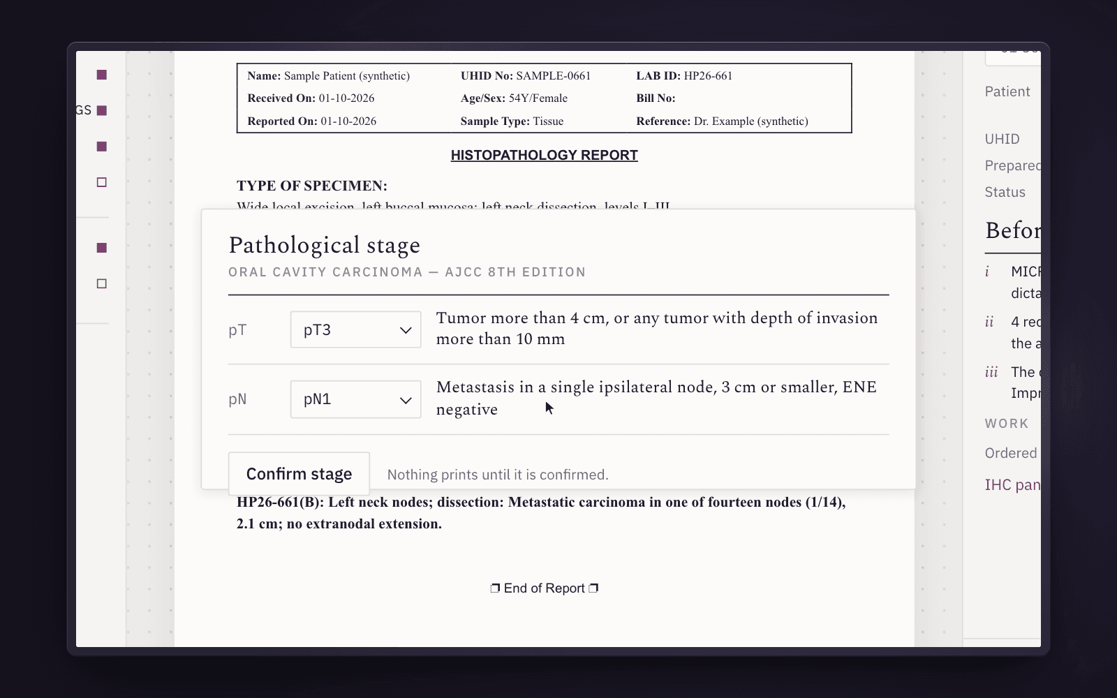 The pathological stage block over the report: pT3 and pN1 chosen, each with its AJCC 8th edition definition, and the Confirm stage button — nothing prints until it is confirmed.